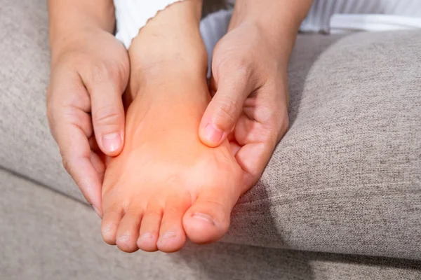 Evde acı veren ayak parmaklarına masaj yapan bir kadının yakın çekimi. Acı verici kırmızı nasırlı (Hallux valgus) ve yaralı ayaklı çıplak ayak, yüksek topuklu giymekten dolayı sorunları olan bir kadın. tıbbi ayak problemi.