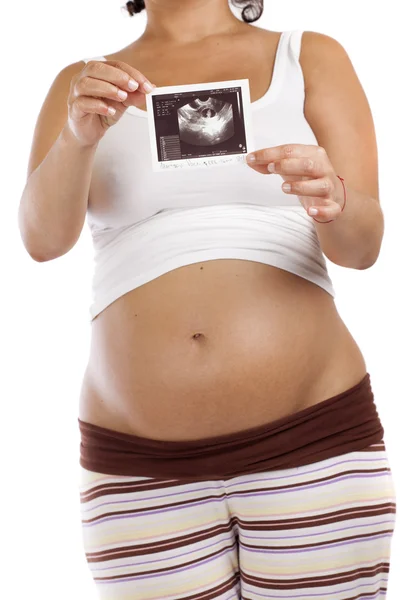 Pregnant woman showing ultrasound image — Stock Photo, Image