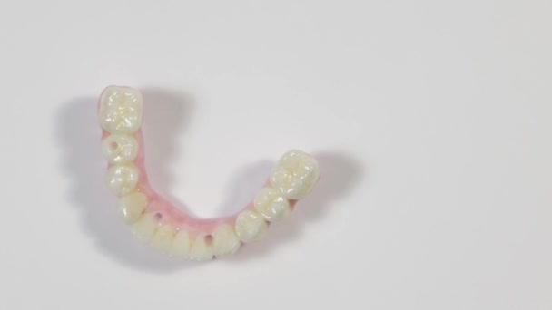 Zahngesundheit Keramisches Zirkonium Aus Nächster Nähe Zahnersatz Auf Zirkonoxid Implantaten — Stockvideo