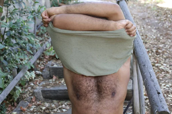 Close Portrait Handsome Shirtless Young Man Outdoors Park — Stock Fotó