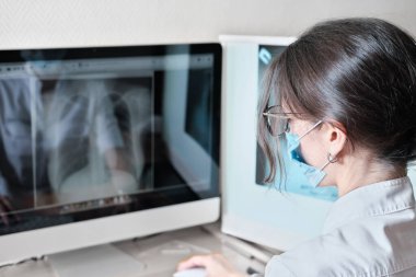 Genç Asyalı kadın radyolog akciğer röntgeni analizi ve röntgenin tıbbi tanımını yapın. arka plan