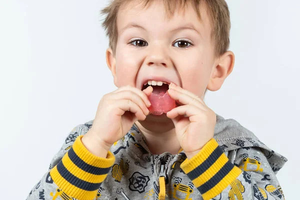 Criança Adorável Coloca Treinador Miofuncional Boca Tariner Dental Feito Para — Fotografia de Stock