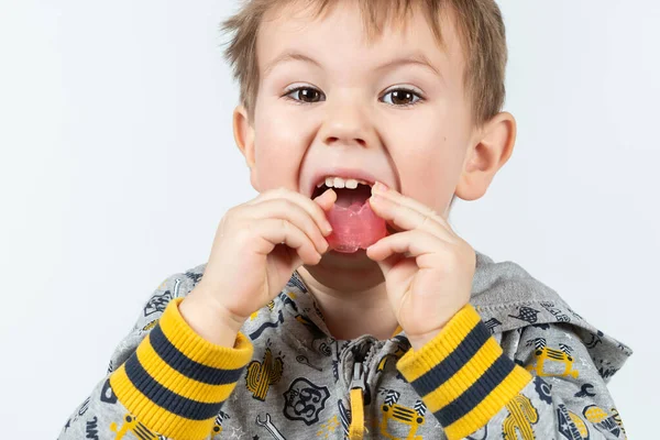 Liebenswertes Kleines Kind Legt Myofunktionstrainer Den Mund Zahntariner Wird Hergestellt Stockbild