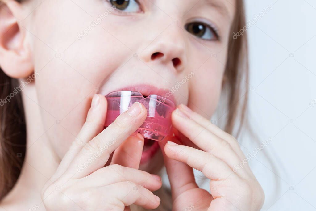 Adorable little girl puts myofunctional trainer in the mouth. dental tariner is made to help equalize the growing teeth and correct bite and Correct the position of the tongue