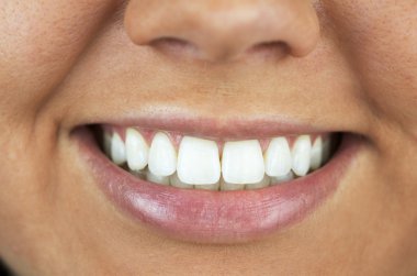 Smile Up Close With Beautiful White Teeth clipart