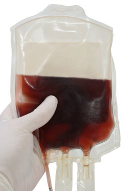 Kan nakli kanlı-bağış