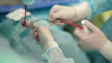 Endoskopik endonazal cerrahi, modern tıp teknolojisi