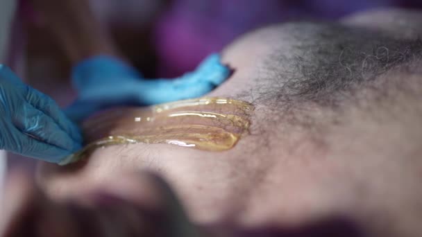 Sugaring for men, master of sugar waxing is removing hair on male chest — Vídeo de Stock