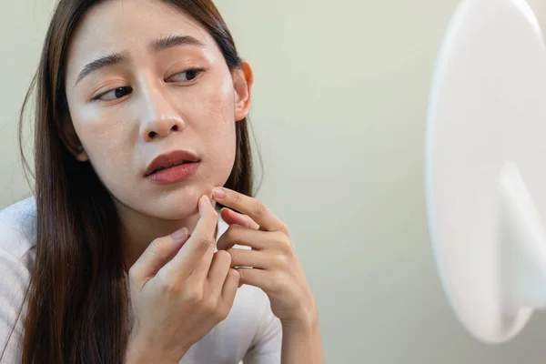 Jovem Mulher Apertando Acne Com Problemas Pele Rosto Espinha Tratamento — Fotografia de Stock