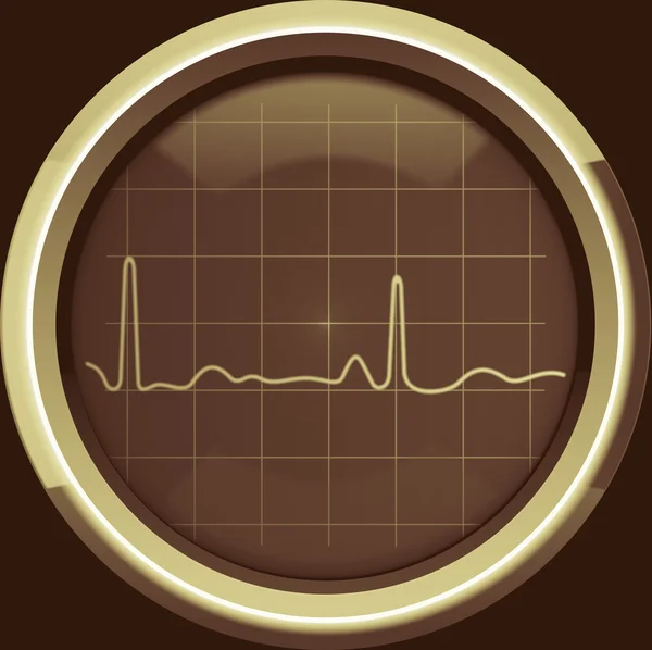 Kardiogram pada layar kardiomonitor dengan nada coklat — Stok Foto
