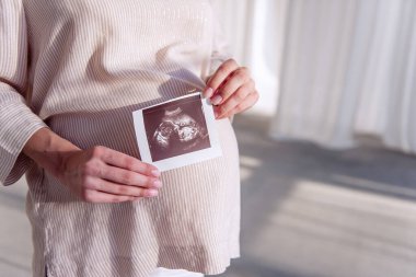 Hamile genç bir kadın elinde ultrason taraması tutuyor. Fetüs fotoğrafta görünüyor. Sağlıklı, mutlu hamilelikler. Tüplü döllenme. Kısırlığın tıbbi tedavisi. Portreyi kapat. Boşluğu kopyala