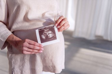 Hamile genç bir kadın elinde ultrason taraması tutuyor. Fetüs fotoğrafta görünüyor. Sağlıklı, mutlu hamilelikler. Tüplü döllenme. Kısırlığın tıbbi tedavisi. Portreyi kapat. Boşluğu kopyala