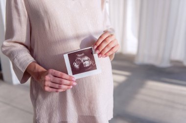 Hamile genç bir kadın elinde ultrason taraması tutuyor. Fetüs fotoğrafta görünüyor. Sağlıklı, mutlu hamilelikler. Tüplü döllenme. Kısırlığın tıbbi tedavisi. Portreyi kapat. Boşluğu kopyala