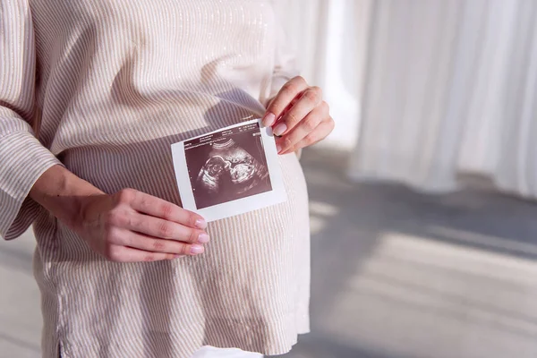 妊娠中の若い女性が手に超音波スキャンを保持し 胎児が写真に表示されます 健康的で幸せな妊娠 体外受精 不妊症の治療 肖像画を閉めろ スペースのコピー — ストック写真