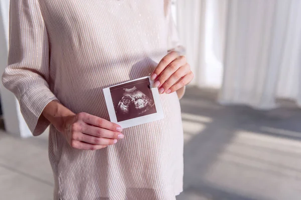 Hamile genç bir kadın elinde ultrason taraması tutuyor. Fetüs fotoğrafta görünüyor. Sağlıklı, mutlu hamilelikler. Tüplü döllenme. Kısırlığın tıbbi tedavisi. Portreyi kapat. Boşluğu kopyala