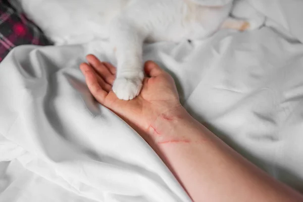 The paw of a white-red cat lies on a violently scratched male hand until it bleeds. Pet attack. Swollen scratches, bites from a wild, rabid animal. Medical care, wound care