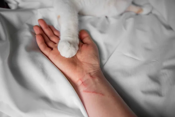 The paw of a white-red cat lies on a violently scratched male hand until it bleeds. Pet attack. Swollen scratches, bites from a wild, rabid animal. Medical care, wound care