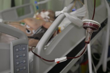 A blood transfusion set hangs on an drip stand surrounded by medical devices. Transfusing blood to a severely anaemic patient in shock in a hospital room of an intensive care unit.