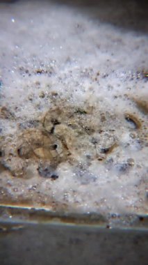 Tuvaletteki kanalizasyonda sıvı kimyasalla kirlenmiş köpük temizleyici..