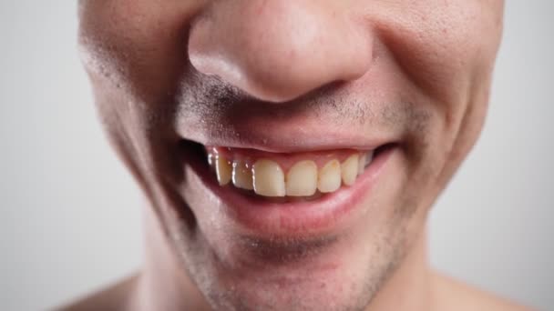 Gros plan, L'homme montre ses dents jaunes tordues et malsaines. Concept de soins dentaires — Video