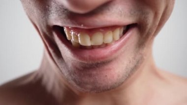 Yakından, Adam Eğri Sarı ve Sağlıksız Dişlerini gösteriyor. Diş Bakımı Konsepti