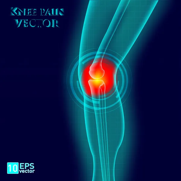 Kneee pain — Stock Vector