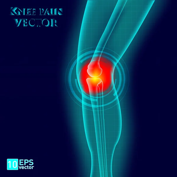 Kneee 痛み — ストックベクタ