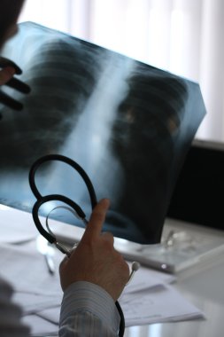 x-ışını resmi, işaret eden doktorun elleri