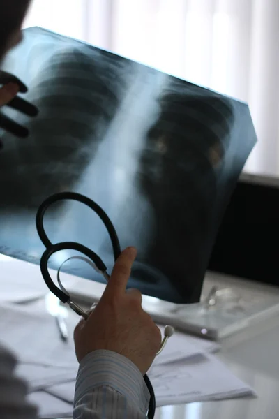 Doctor's hands pointing at a X-ray picture — Stock Photo, Image