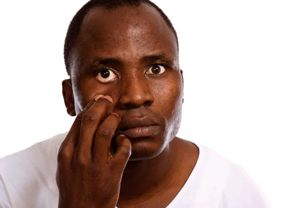 Man with contact lens — Stock Photo, Image