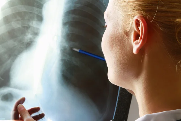 Female doctor with an x-ray — Stock Photo, Image