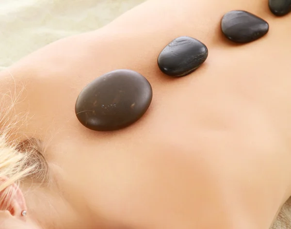 Mujer recibiendo una terapia con piedras calientes —  Fotos de Stock