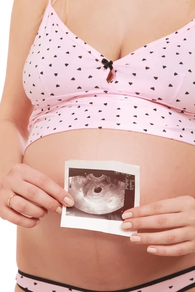 Pregnant woman holding an ultrasound picture of her baby — Stock Photo, Image