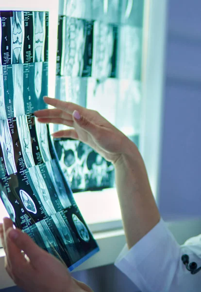 Orvosok Csoportja Akik Röntgent Néznek Egy Kórházban — Stock Fotó