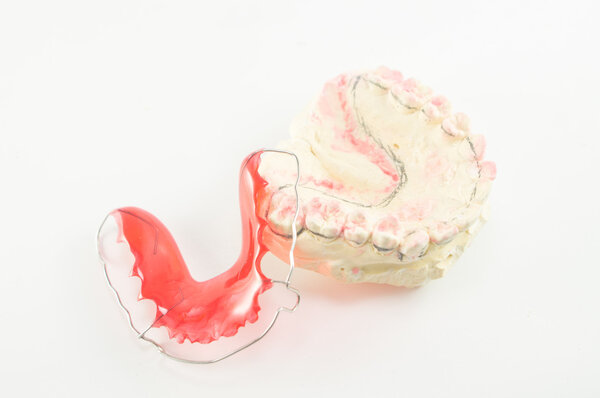 Стоматологическая скобка и фиксатор на белом фоне
.