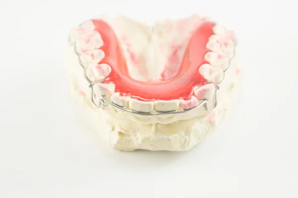 Tutore dentale e fermo su sfondo bianco . — Foto Stock