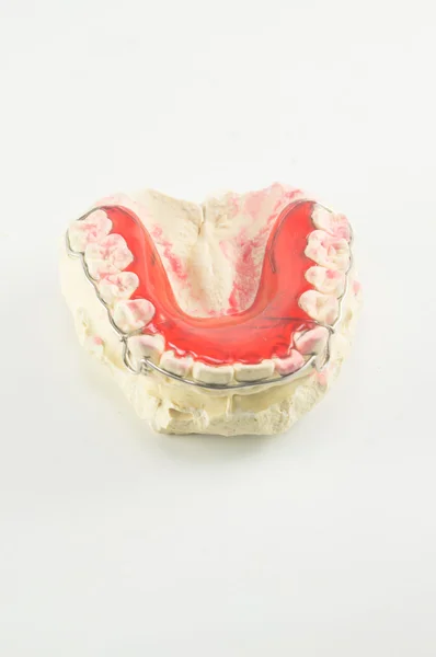 Tutore dentale e fermo su sfondo bianco . — Foto Stock