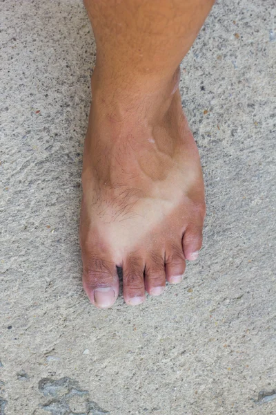Opálené nohy, když se nosí sandály na slunci na dlouhou dobu — Stock fotografie