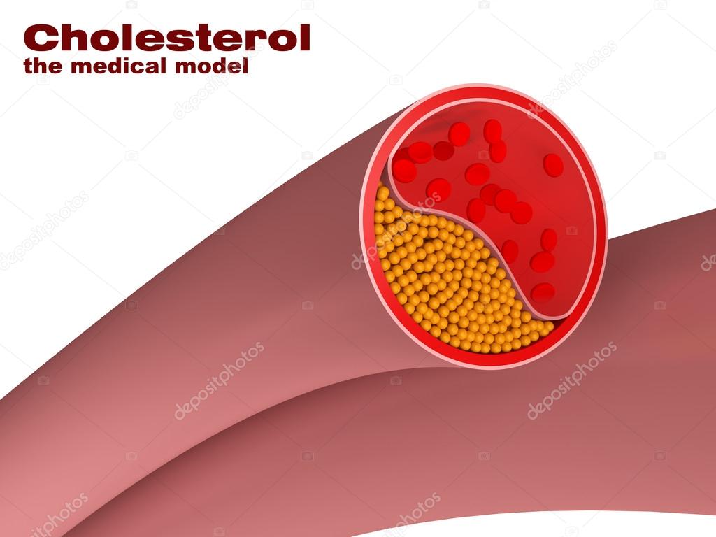 model of cholesterol in artery