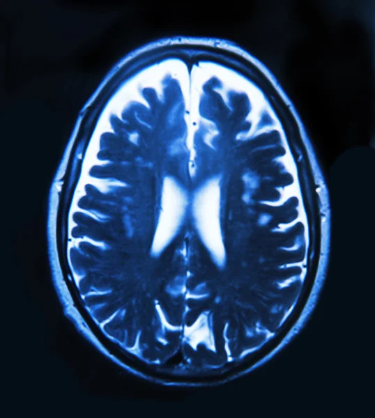 Imaging del cervello — Foto Stock
