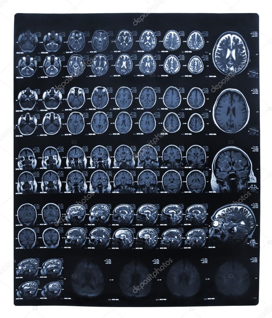 Imaging of the brain