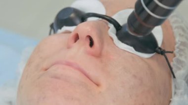 Kozmetik prosedürü. Güzellik salonunda karbon soyma işlemi sırasında koruyucu gözlük takan genç bir kızın yüzü.