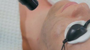 Kozmetik prosedürü. Güzellik salonunda karbon soyma işlemi sırasında koruyucu gözlük takan genç bir kızın yüzü.