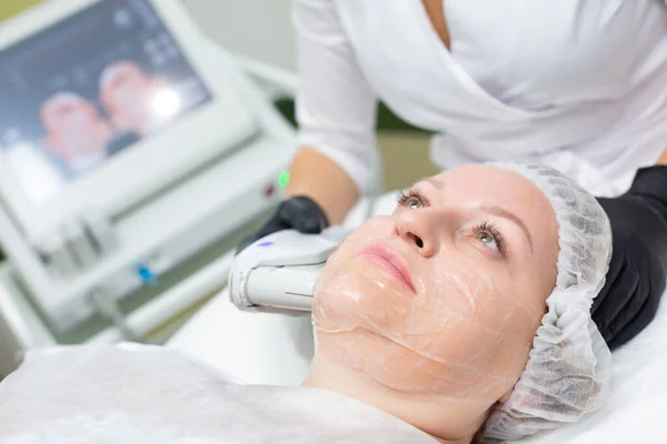 Kobieta w gabinecie kosmetologii przechodzi zabieg podnoszenia SMAS. Niechirurgiczne podnoszenie twarzy, odmładzanie, nawilżanie, usuwanie zmarszczek, odcień i elastyczność skóry — Zdjęcie stockowe