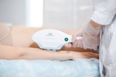 Modern bir kozmetoloji ofisinde profesyonel bir uzman tarafından genç bir kızın kolunda lazer kılı alınması.