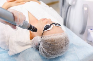 Bir güzellik salonunda karbon soyma işlemi sırasında koruyucu gözlük takan genç bir kızın fotoğrafı.