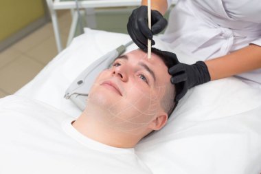 Siyah eldiven giymiş bir kozmetik uzmanının elleri beyaz bir kozmetik kalem tutarken, dermatoloji ofisinde kanepede yatan yakışıklı bir adamın portresi.