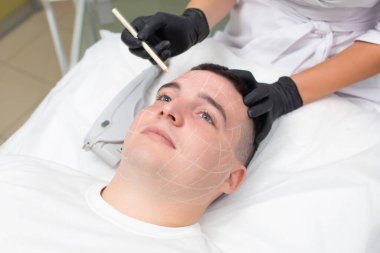 Siyah eldiven giymiş bir kozmetik uzmanının elleri beyaz bir kozmetik kalem tutarken, dermatoloji ofisinde kanepede yatan yakışıklı bir adamın portresi.