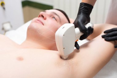 Genç ve yakışıklı bir adam kozmetoloji bürosunun kanepesinde ellerini kaldırmış koltukaltından lazer tüy çıkarma işlemi sırasında yatıyor.