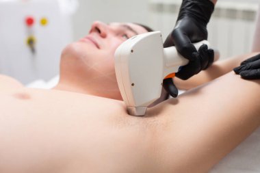 Genç ve yakışıklı bir adam kozmetoloji bürosunun kanepesinde ellerini kaldırmış koltukaltından lazer tüy çıkarma işlemi sırasında yatıyor.